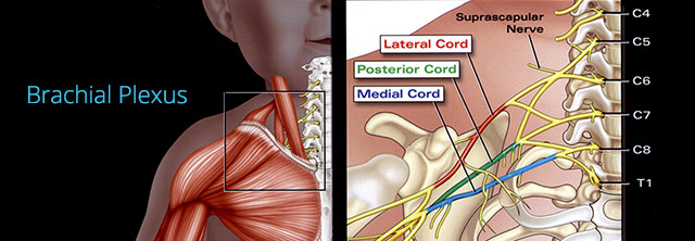 what is brachial plexus diagram